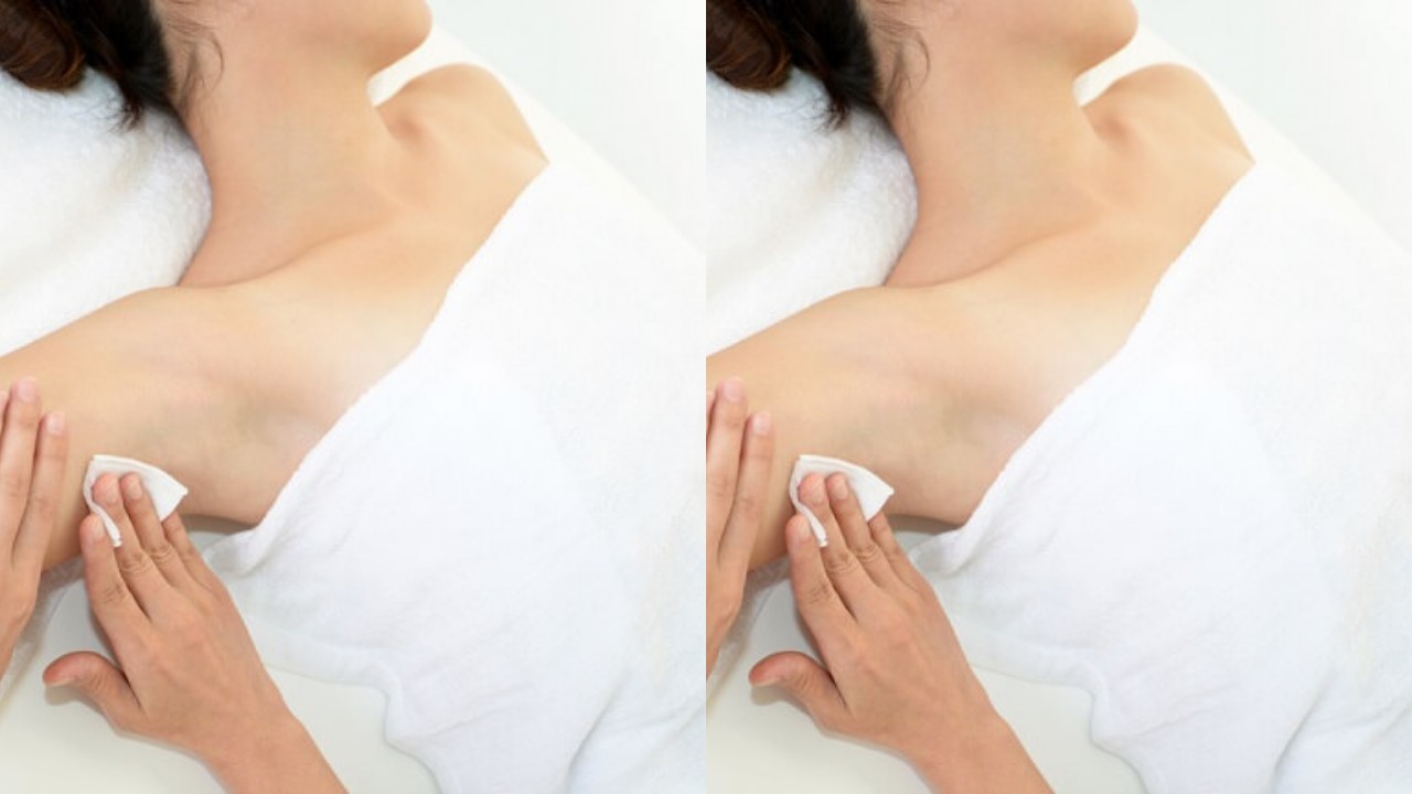 Tips Mengobati Bisul di Ketiak yang Efektif, Yang Mudah Dilakukan!