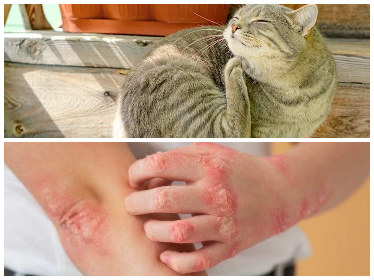 Waspada! Ini Ciri-Ciri Gigitan Kutu Kucing pada Manusia yang Perlu Kamu Kenali