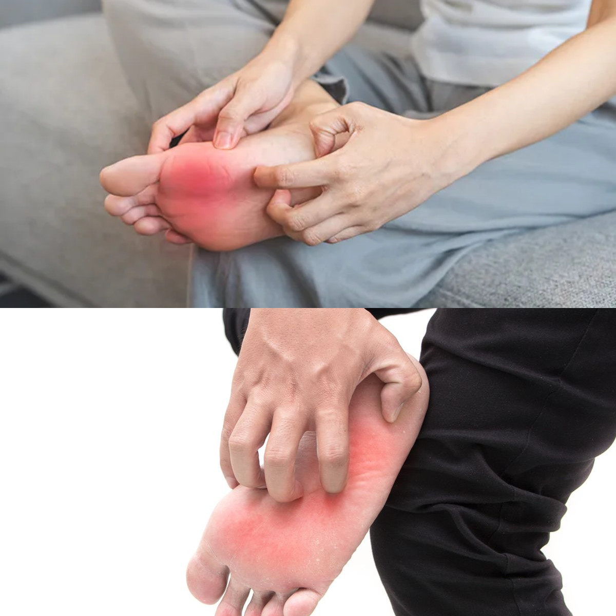  Telapak Kaki Gatal? Ini Penyebab Yuk Simak !