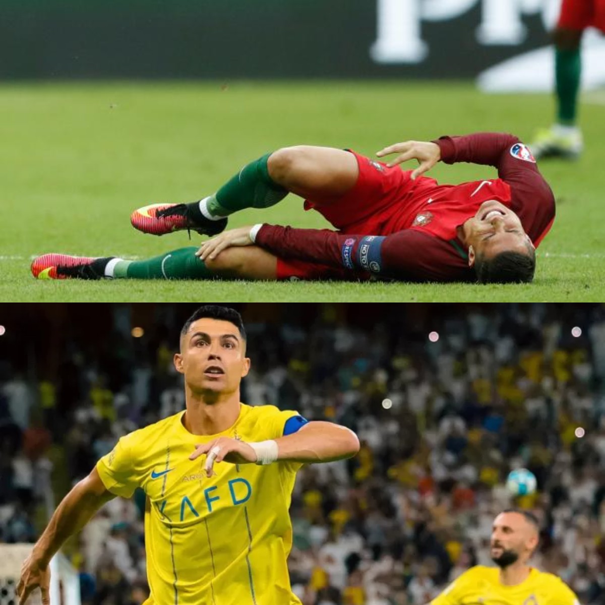 Kondisi Kaki Mega Bintang Portugal Bikin Khawatir Fans Sepakbola!