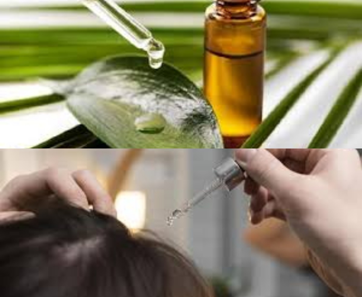 Ini 4 Manfaat Tea Tree Oil untuk Kesehatan Rambut, Bisa Atasi Kutu Juga Loh!