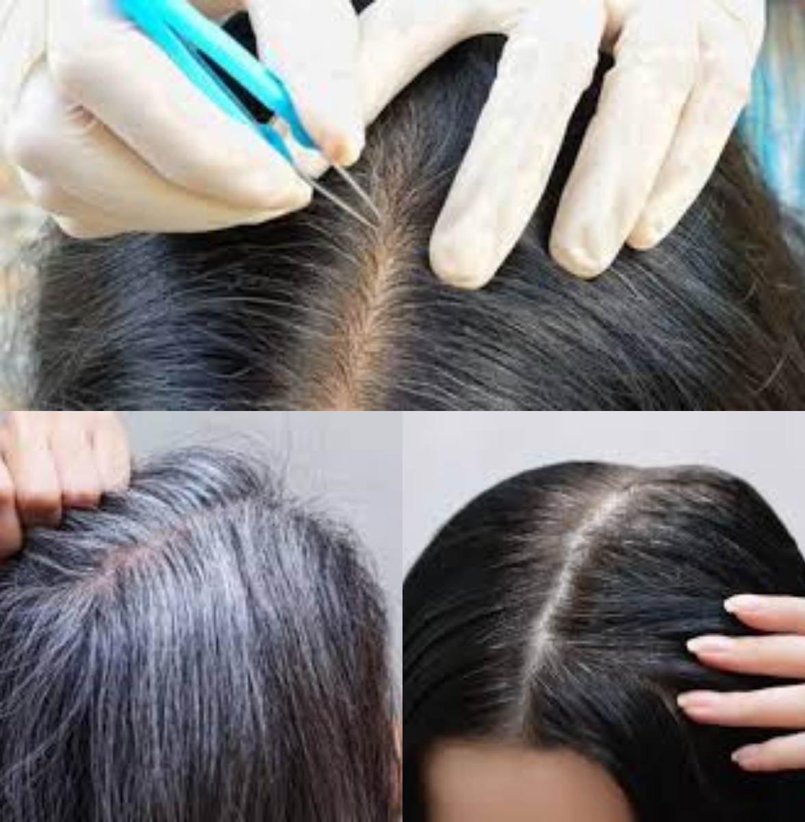 Rambut Beruban Dini: Penyebab Tersembunyi dan Cara Alami Mengatasinya