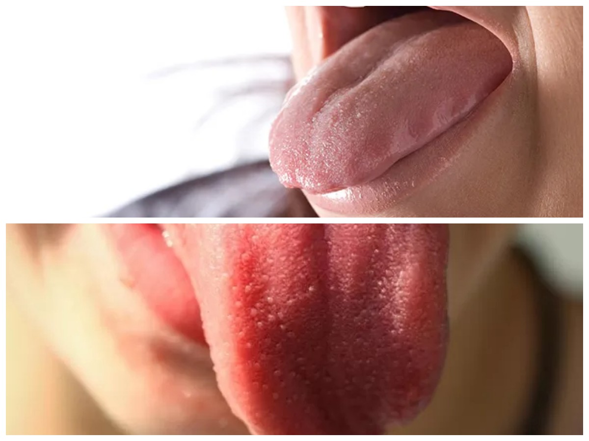 Rasa Manis di Mulut? Kenali Penyebab, Risiko, dan Solusi Medis yang Tepat