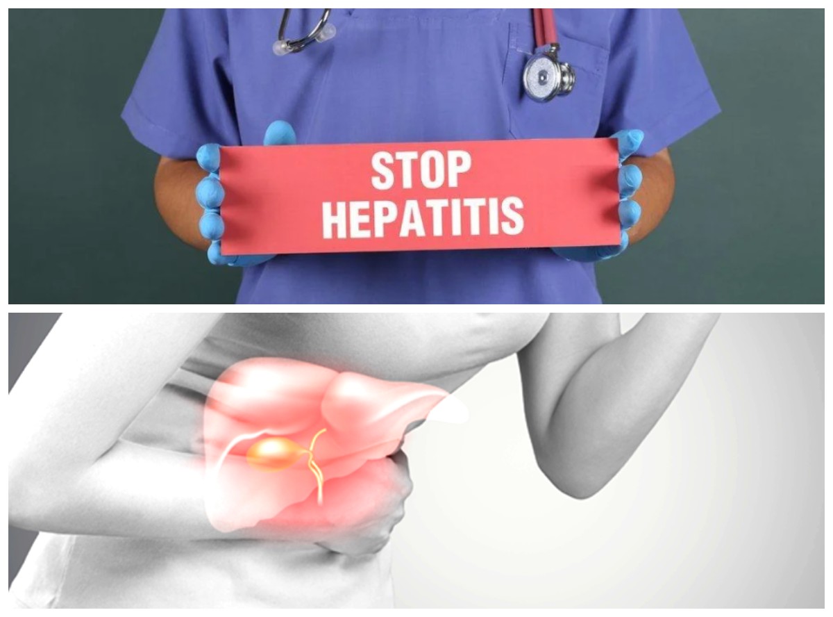 6 Kebiasaan yang Harus Ditinggalkan untuk Mencegah Penyakit Hepatitis