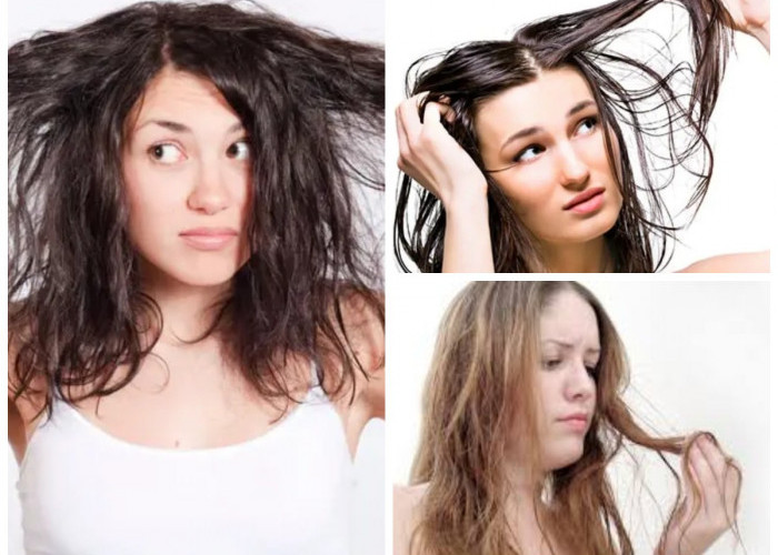 Beragam Tips Mengatasi Rambut Lepek, Simak Cara Mengatasinya!