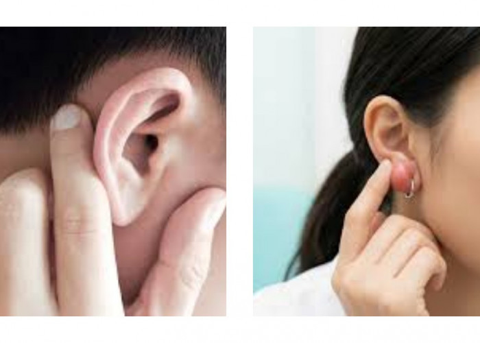 Benjolan di Daun Telinga: Penyebab dan Cara Mengatasinya