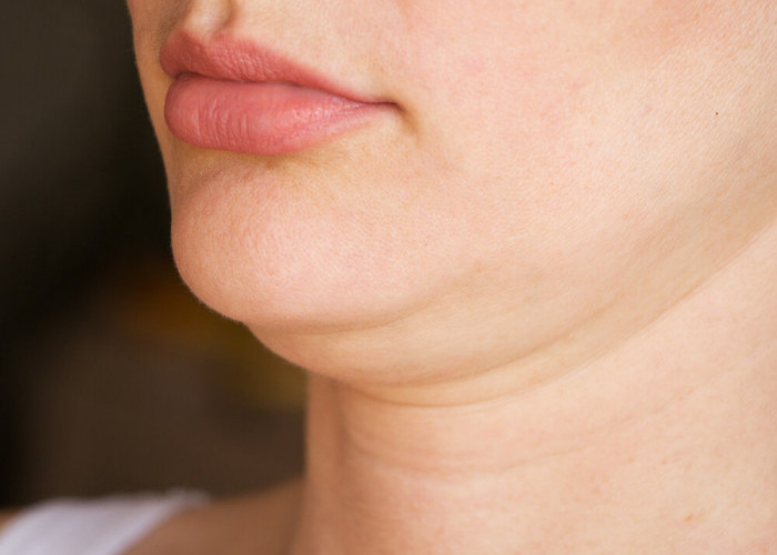 Apa Penyebab Double Chin dan Bagaimana Cara Mengatasinya? Yuk Simak Penjelasannya