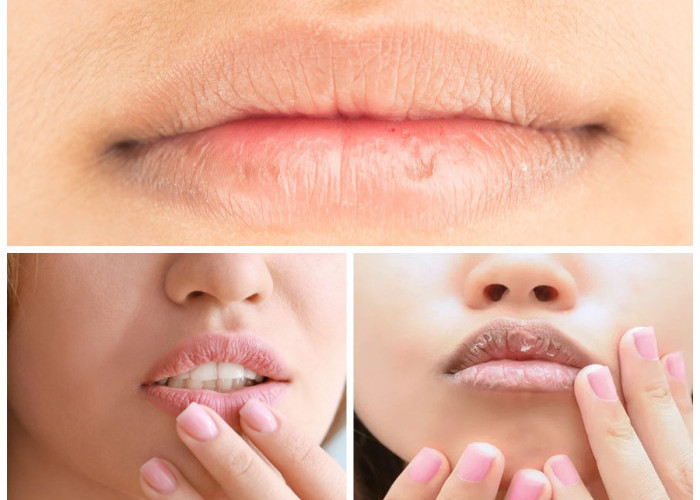 Bibir Kering? inilah Berbagai Cara/Tips Mencegah Bibir Kering!