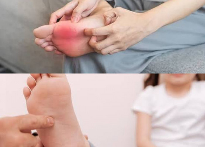 sangat Mengganggu Kenyamanan, Kenali Faktor Pemicu Gatal di Telapak Kaki dan Cara Mengobatinya!
