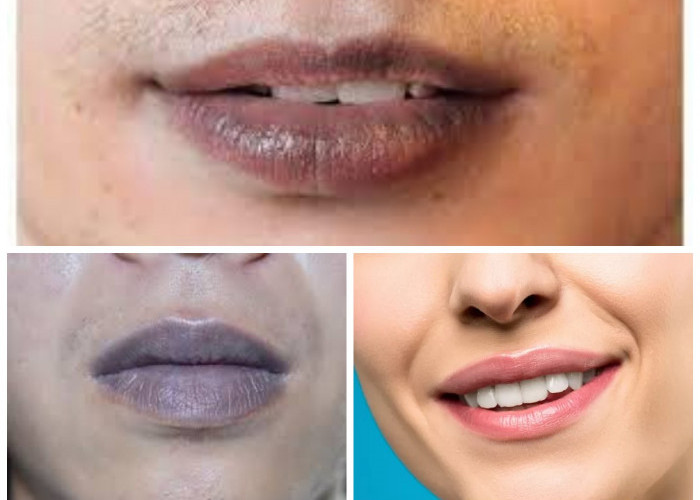 Bibir Hitam Tidak Percaya Diri? Inilah Tips Mengatasi Bibir Hitam, Ampuh dan Alami!