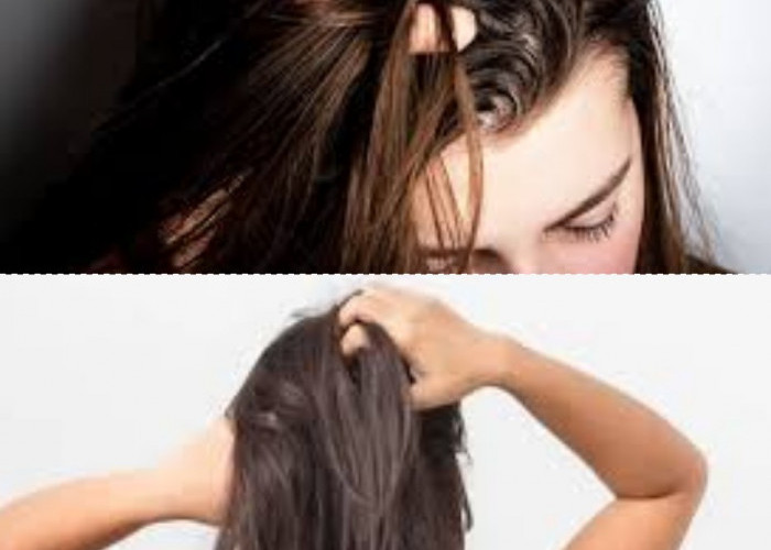 Rambut Berminyak Berlebihan Antara Genetik dan Kebiasaan Harian