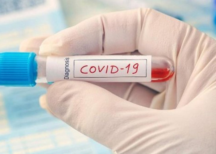 Menkes Umumkan Penambahan Kasus COVID-19 Varian Kraken di Indonesia 
