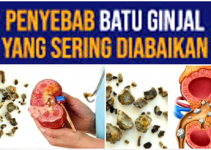 10 Hal Pemicu Batu Ginjal. Jangan Diabaikan!