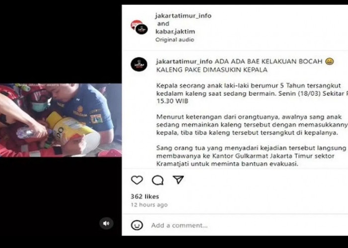 Heboh, Kepala Bocah 5 Tahun Tersangkut Kaleng Susu di Jakarta Timur, Petugas Damkar Turun Tangan