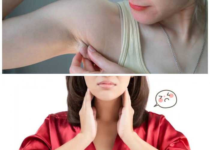 Cara Efektif Mengatasi Pembengkakan pada Getah Bening