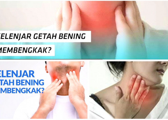 Jangan Sampai Tidak Tahu Cara Mudah Atasi Getah Bening
