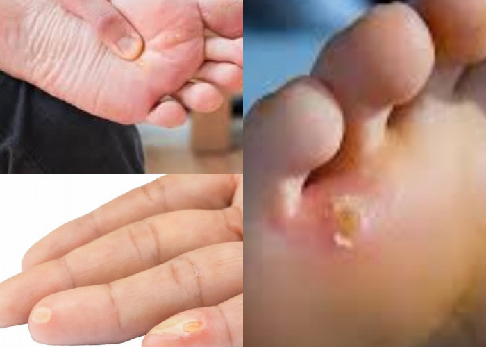 Penyakit Mata Ikan: Penyebab, Gejala, dan Cara Pengobatannya