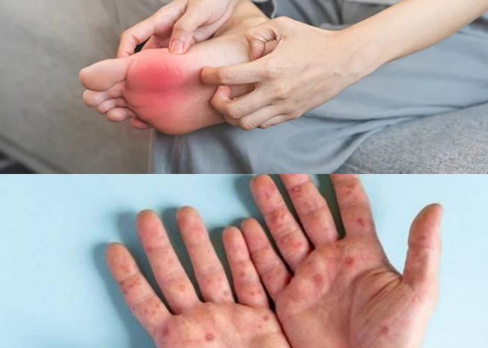 Sering Gatal di Tangan dan Kaki Tanpa Sebab? Ini 7 Kemungkinan Penyebabnya