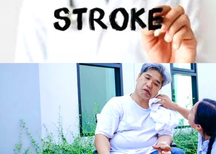 Jarang Disadari! 6 Kebiasaan Ini Tingkatkan Resiko Terkena Stroke