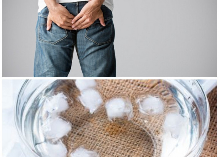 Redakan Wasir dengan Cepat: Metode Alami yang Aman dan Mudah Dilakukan di Rumah