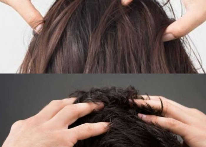 Cuma di Rumah, Rambut Bisa Sehat & Kuat Pria dan Wanita Wajib Tahu