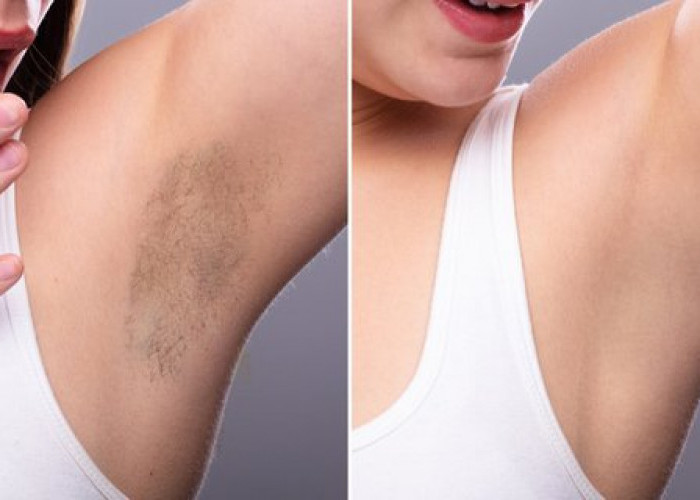7 Cara Cukur Bulu Ketiak Yang Benar dengan Hasil Maksimal