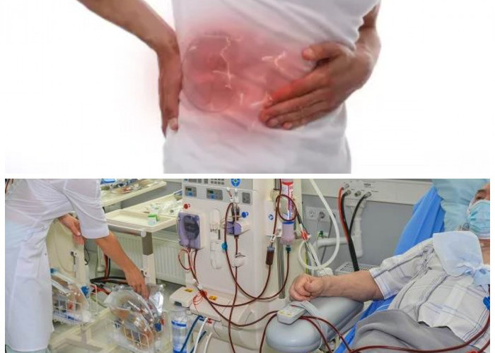 Panduan Mengatasi Penyakit Ginjal Stadium Awal Secara Efektif dan Aman