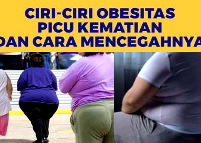 Picu Resiko Kematian. Ciri-ciri dan Bahaya Obesitas yang Tak Bisa Dianggap Remeh! 