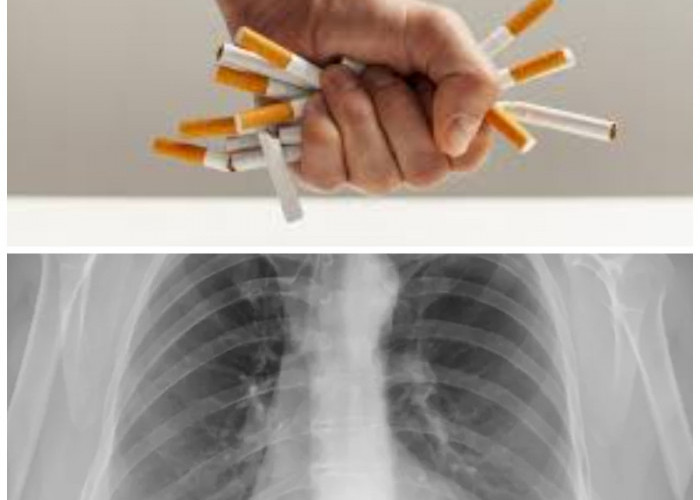 Cara Ampuh Membersihkan Paru-paru untuk Perokok Aktif
