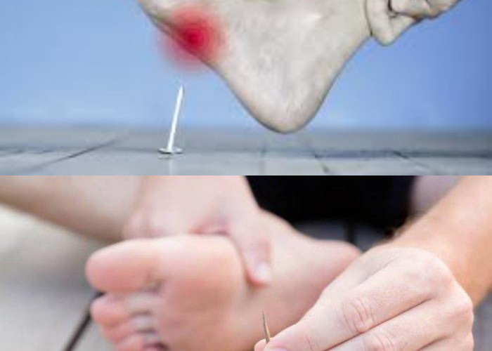 6 Obat Tetanus agar Infeksi Tidak Makin Parah!