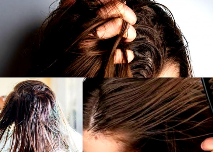Bikin Ngga Percaya Diri? Begini Cara Ampuh Atasi Rambut Lepek Berminyak!