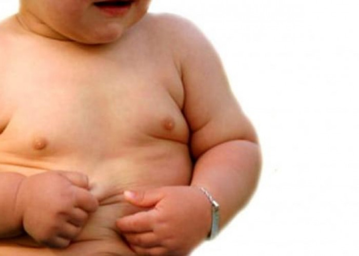 Waspada Bunda, Ini 7 Tanda Bayi Anda Obesitas!