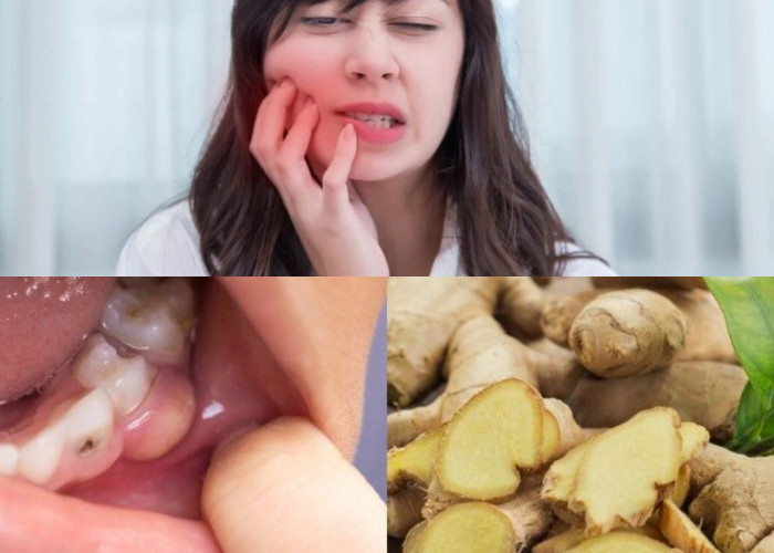 8 Metode Efektif untuk Mengurangi Rasa Sakit Gigi. Mudah Diterapkan di Rumah!