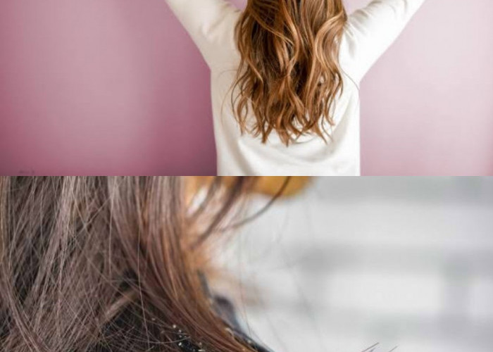 Sudah Ganti Shampoo Empat Kali, Tapi Ketombe Masih Setia