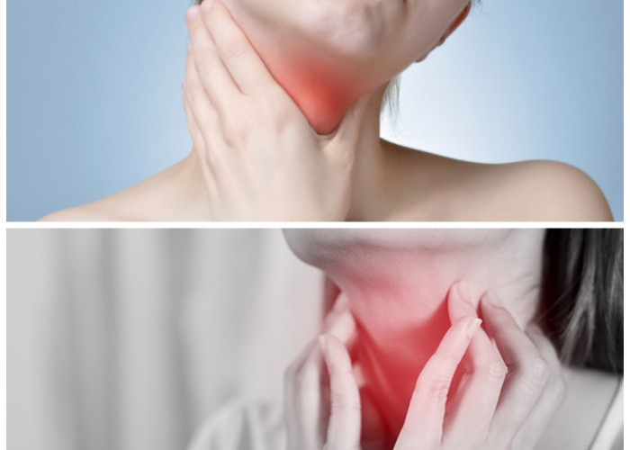 Efektif dan Mudah: 5 Tips Meredakan Sakit Tenggorokan