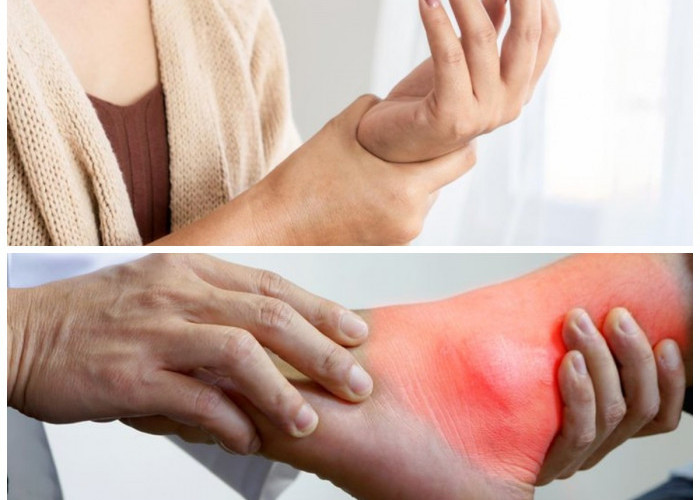 Asam Urat Sering Diabaikan? Ketahui Tanda Awal, Faktor Pemicu, dan Solusi Pengobatannya