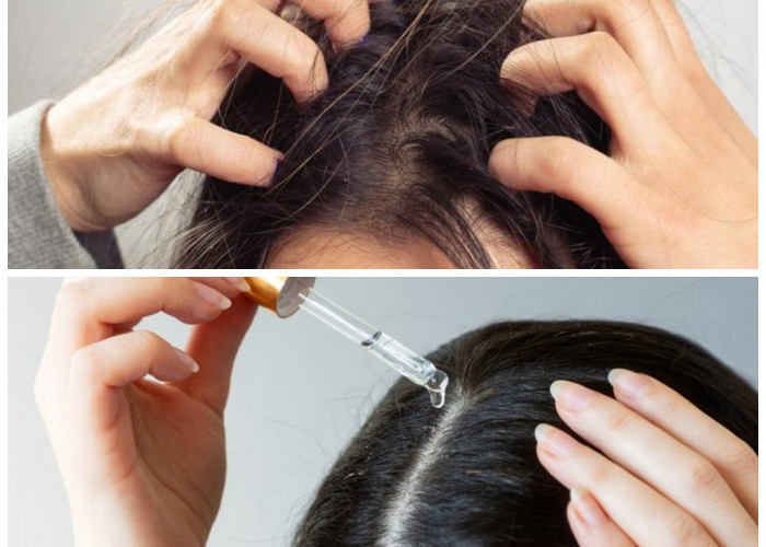  7 Cara Ampuh Menyuburkan Rambut dan Merawat Kulit Kepala