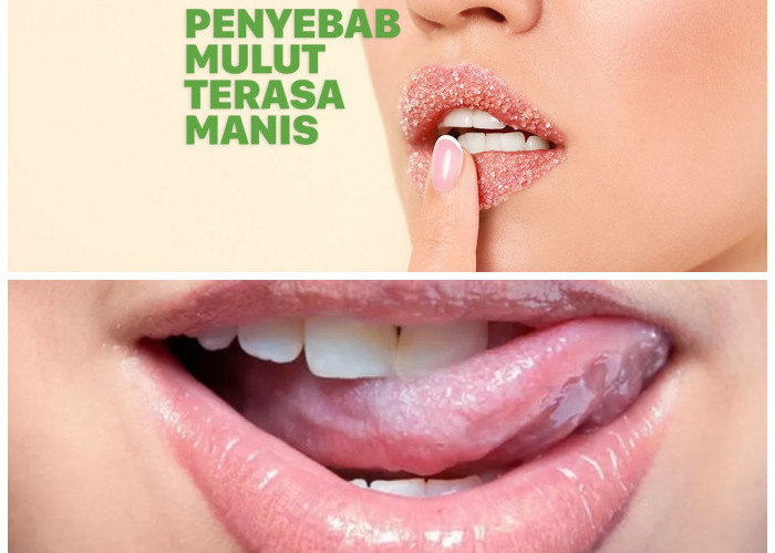 Mengapa Mulut Terasa Manis? Panduan Lengkap dari Penyebab hingga Cara Mengatasinya