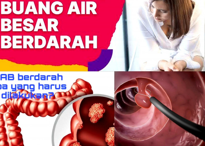 Kenali Penyebab dan Cara Mengatasi BAB Berdarah