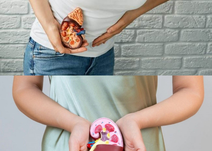  Inilah Cara Mengobati Penyakit Ginjal Stadium Awal!