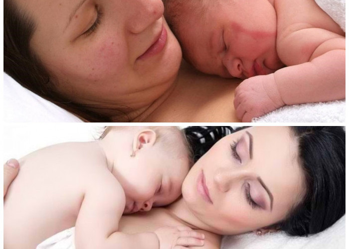 Skin to Skin Contact: Rahasia Lancarnya Menyusui dan Kedekatan Ibu-Bayi Sejak Dini