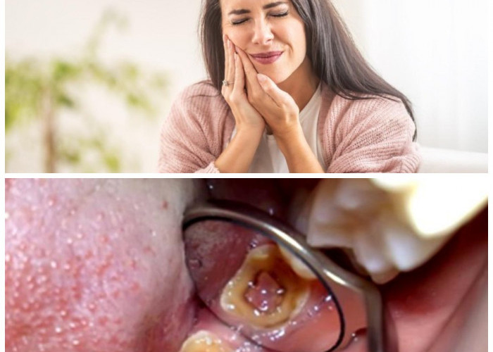 Cara Mengatasi Sakit Gigi yang tak Kunjung Sembuh