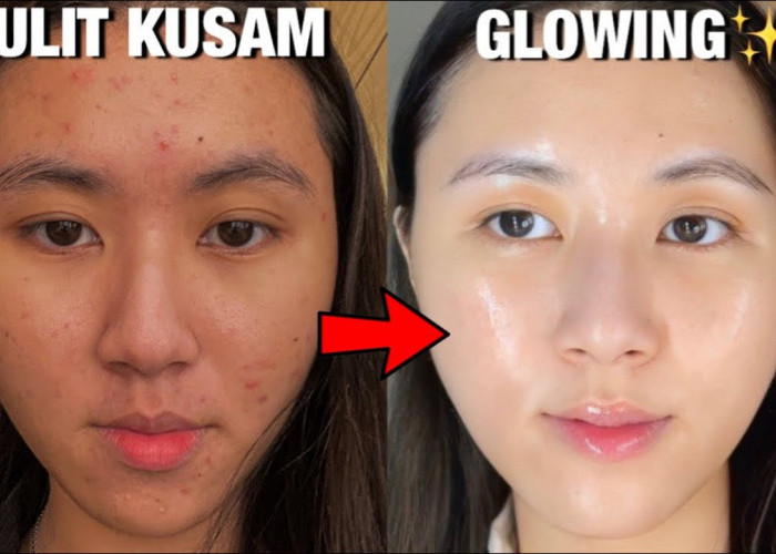 Kulit Kusam? Yuk Atasi dengan 5 Tips Mudah Ini!