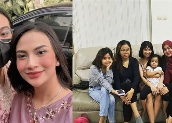 Potret Perubahan Hidung Mayang Adik Vanessa Angel, Bikin Pangling Tambah Cantik Kaya Kakaknya