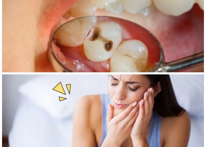 Waspada! Ternyata Inilah Penyebab Sakit Gigi yang tak Kunjung Sembuh
