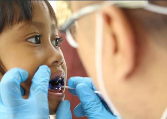 Rahasia Merawat Gigi Anak, Begini Tips Mengatasi Kerusakan dengan Tindakan Tepat