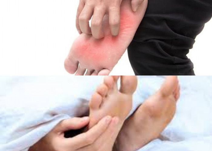 Bukan Cuma Kutu Air! Ternyata Ini 4 Faktor Utama Penyebab Telapak Kaki Gatal Tak Tertahankan