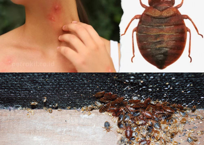 Inilah Gejala dan Penyebab Kutu Kasur Yang Wajib Anda Tahu!