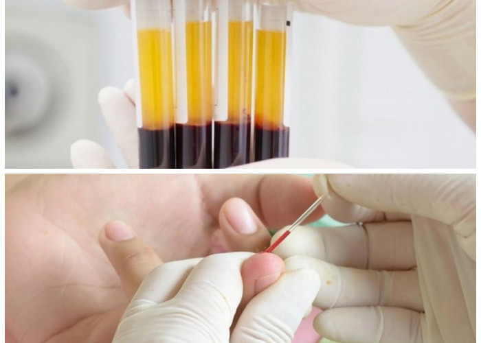 Fakta Menarik Golden Blood: Golongan Darah Paling Langka yang Dimiliki Segelintir Orang