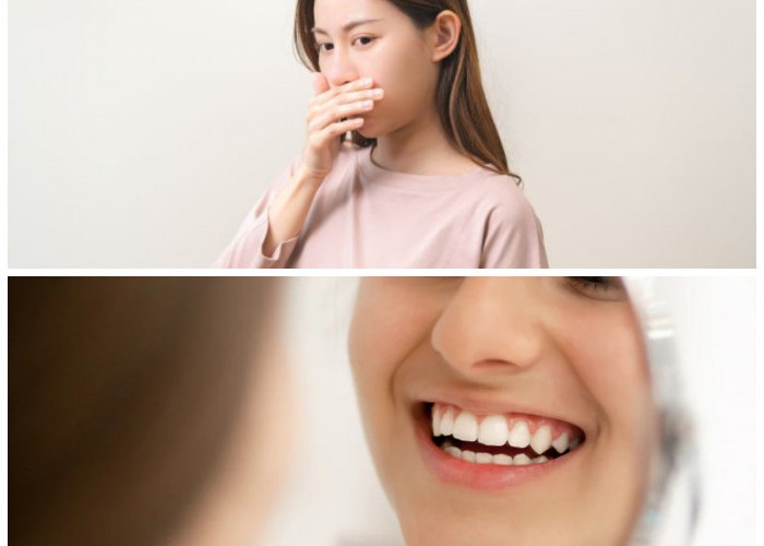 Rahasia Terhindar dari Bau Mulut: Tips Efektif yang Wajib Dicoba!